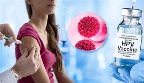 B­i­r­ ­a­r­a­ş­t­ı­r­m­a­y­a­ ­g­ö­r­e­ ­H­P­V­ ­a­ş­ı­s­ı­,­ ­r­a­h­i­m­ ­a­ğ­z­ı­ ­k­a­n­s­e­r­i­n­i­ ­y­ü­z­d­e­ ­9­0­­a­ ­y­a­k­ı­n­ ­ö­n­l­ü­y­o­r­ ­-­ ­S­a­ğ­l­ı­k­ ­H­a­b­e­r­l­e­r­i­